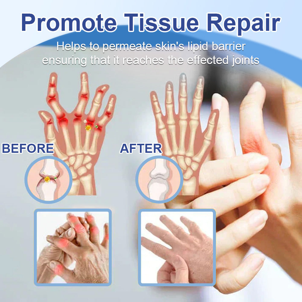 50%Discount✅TGA Approved: Ourlyard® Magnesium Pain Healing Bone Cream (Treatment for arthritis, neuropathyy, rheumatic diseases, muscle spasms, twitches and sports injuries)