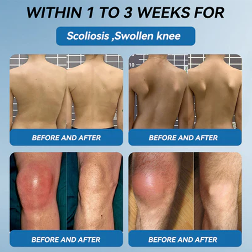 โ
๐๐ฏ๐จ๐๐ฏ๐จยฎ ๐ฉ๐๐-๐๐๐ Joint Cream (๐ฆ๐บ Relief for Arthritis, Neuropathy, Sports Injuries & Rheumatism)