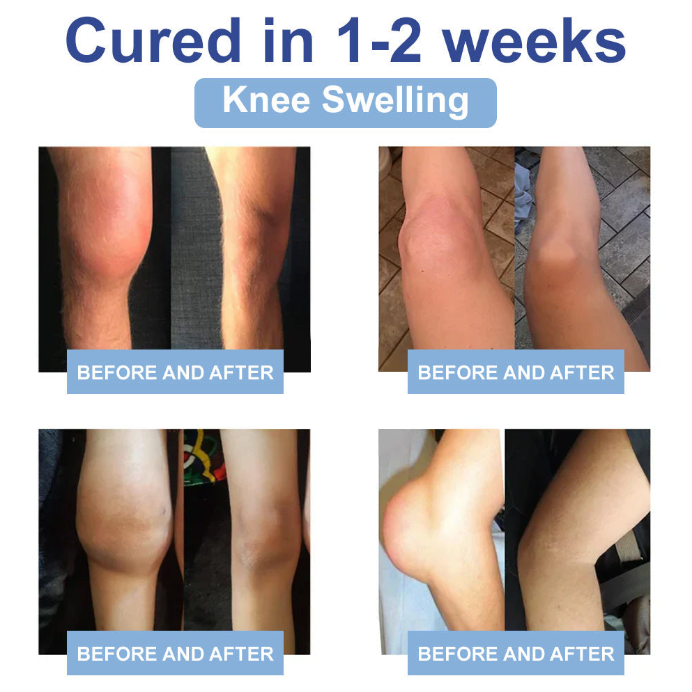 ✅FDA Certified :  Rekulo® Black Rice Pain Healing Bone Cream ( Treatment for arthritis, neuropathyy, rheumatic diseases, sports injuries, twitches and muscle spasms)