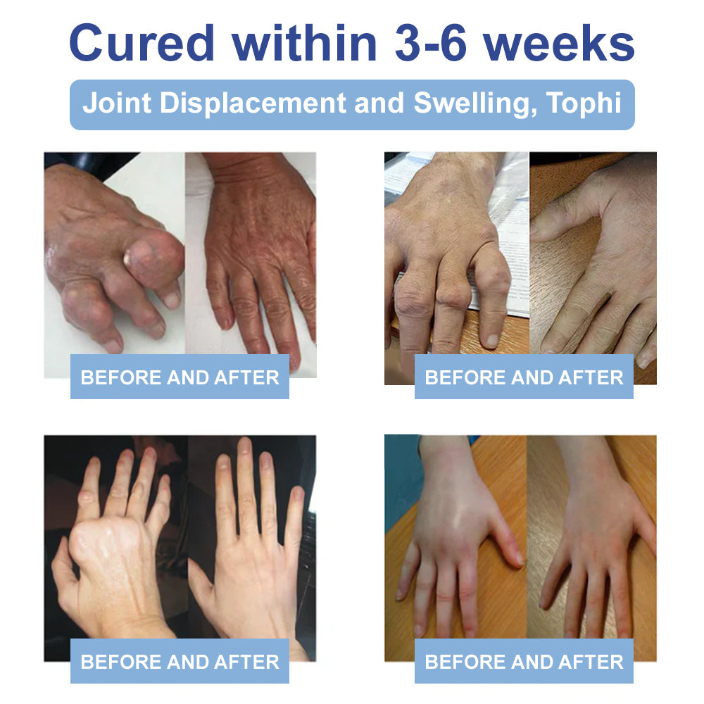 ✨TGA Approved: Ourlyard® Magnesium Pain Healing Bone Cream (Treatment for arthritis, neuropathyy, rheumatic diseases, muscle spasms, twitches and sports injuries)