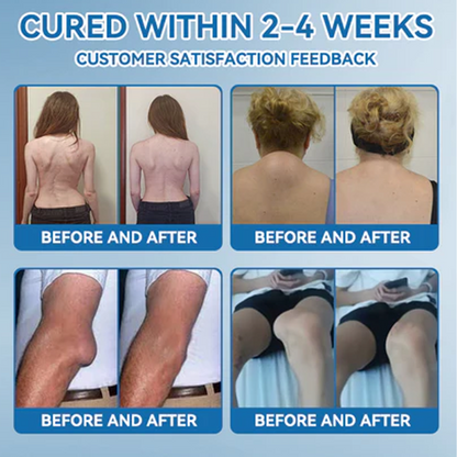 ✅𝒁𝐯𝐨𝐞𝐯𝐨® 𝑩𝐏𝐂-𝟏𝟓𝟕 Joint Cream (🇦🇺 Relief for Arthritis, Neuropathy, Sports Injuries & Rheumatism)