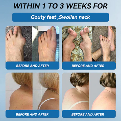 ✅𝒁𝐯𝐨𝐞𝐯𝐨® 𝑩𝐏𝐂-𝟏𝟓𝟕 Joint Cream (🇦🇺 Relief for Arthritis, Neuropathy, Sports Injuries & Rheumatism)