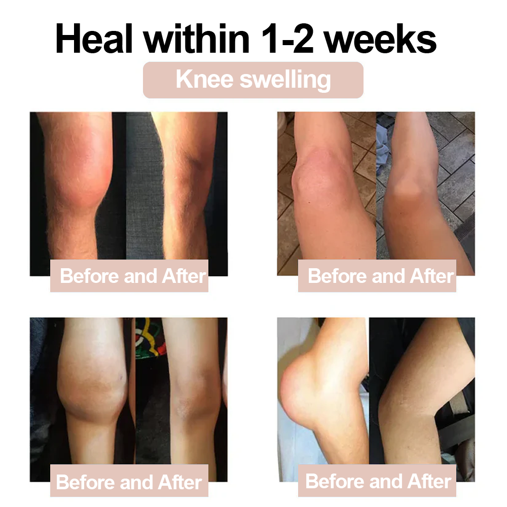 ✅Zvoevo® Magnesium Glycinate Joint Repair Cream (Effective relief for arthritis, nerve pain, rheumatic conditions, muscle spasms, and sports injuries)