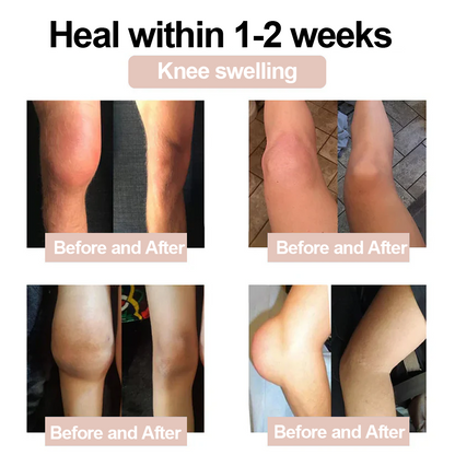 ✅Zvoevo® Magnesium Glycinate Joint Repair Cream (Effective relief for arthritis, nerve pain, rheumatic conditions, muscle spasms, and sports injuries)