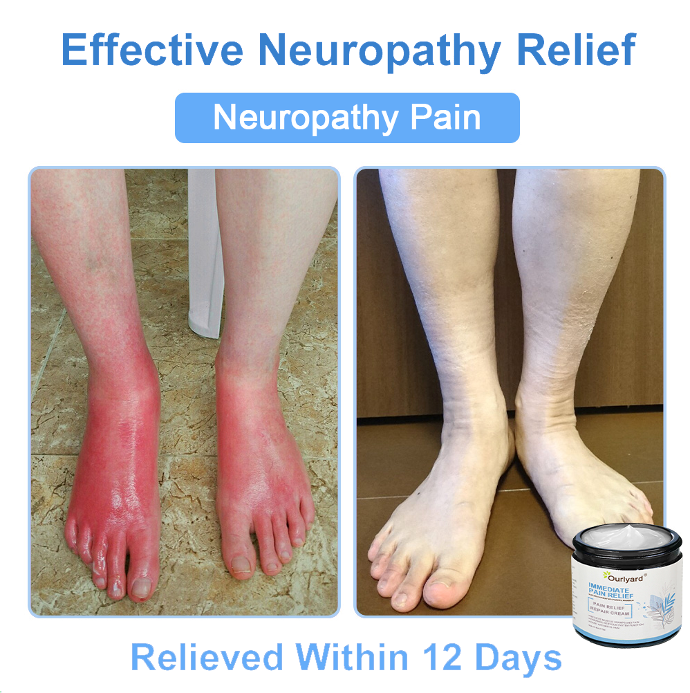 ✨TGA Approved: Ourlyard® Magnesium Pain Healing Bone Cream (Treatment for arthritis, neuropathyy, rheumatic diseases, muscle spasms, twitches and sports injuries)