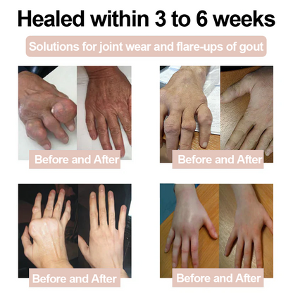 ✅Zvoevo® Magnesium Glycinate Joint Repair Cream (Effective relief for arthritis, nerve pain, rheumatic conditions, muscle spasms, and sports injuries)