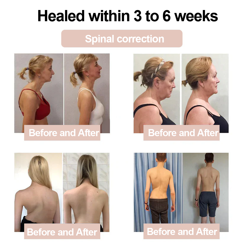 ✅Zvoevo® Magnesium Glycinate Joint Repair Cream (Effective relief for arthritis, nerve pain, rheumatic conditions, muscle spasms, and sports injuries)